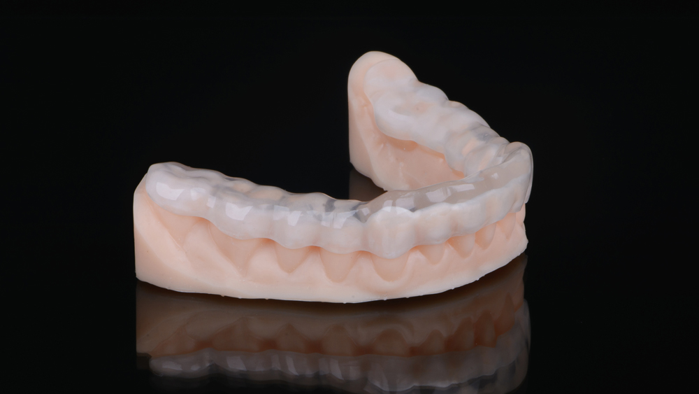 black dental model of the jaw with a bridge prosthesis and zirco